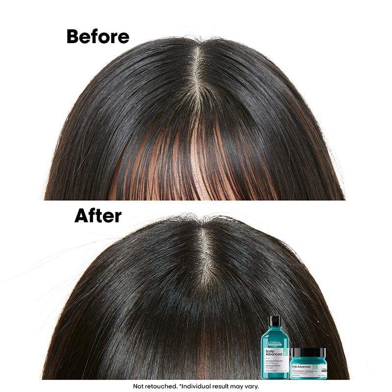 L'Oreal Professionnel Scalp Advanced Anti-Oiliness Dermo-Purifier Shampoo for Oily Scalps (300ml)