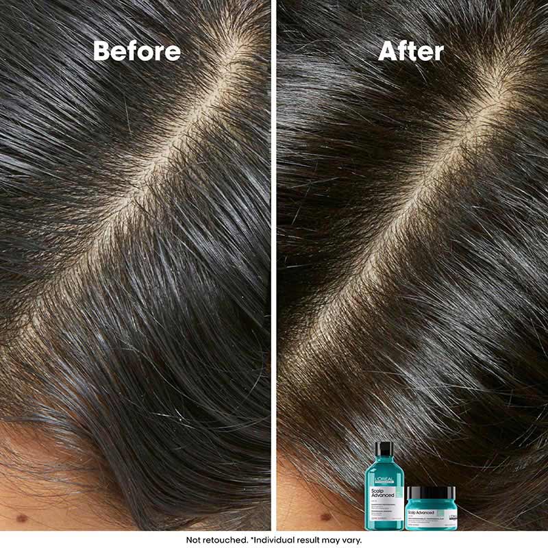 L'Oreal Professionnel Scalp Advanced Anti-Oiliness Dermo-Purifier Shampoo for Oily Scalps (300ml)