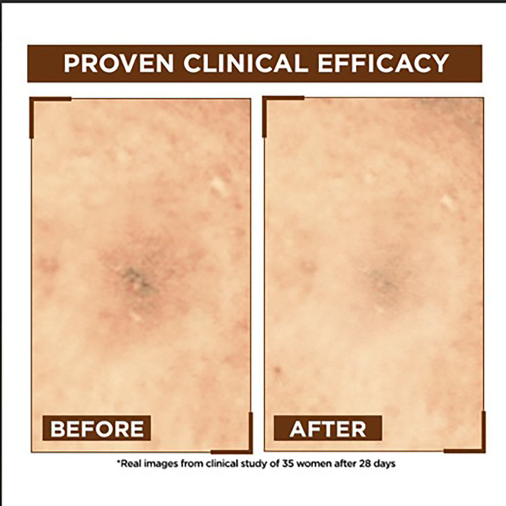 Garnier Bright Complete OverNight Booster Vitamin C + Serum With 10% Pure Vitamin C To Repair & Brighten Skin