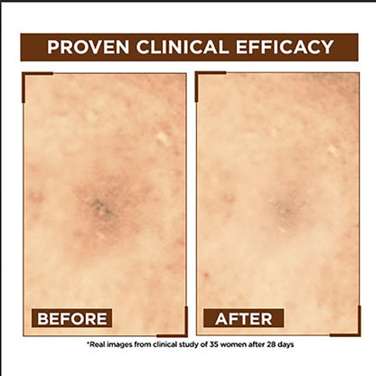 Garnier Bright Complete OverNight Booster Vitamin C + Serum With 10% Pure Vitamin C To Repair & Brighten Skin