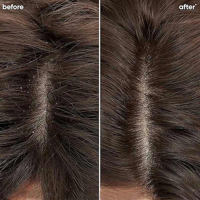 Biolage Advanced Scalppure Anti-Dandruff Shampoo – 72‑Hour Scalp Detox 200ml